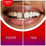 colgate-max-white-ultimate-rad-QCWBMoSJ-0.webp