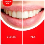 colgate-max-white-ultra-freshn-bKAZwxRM-0.webp