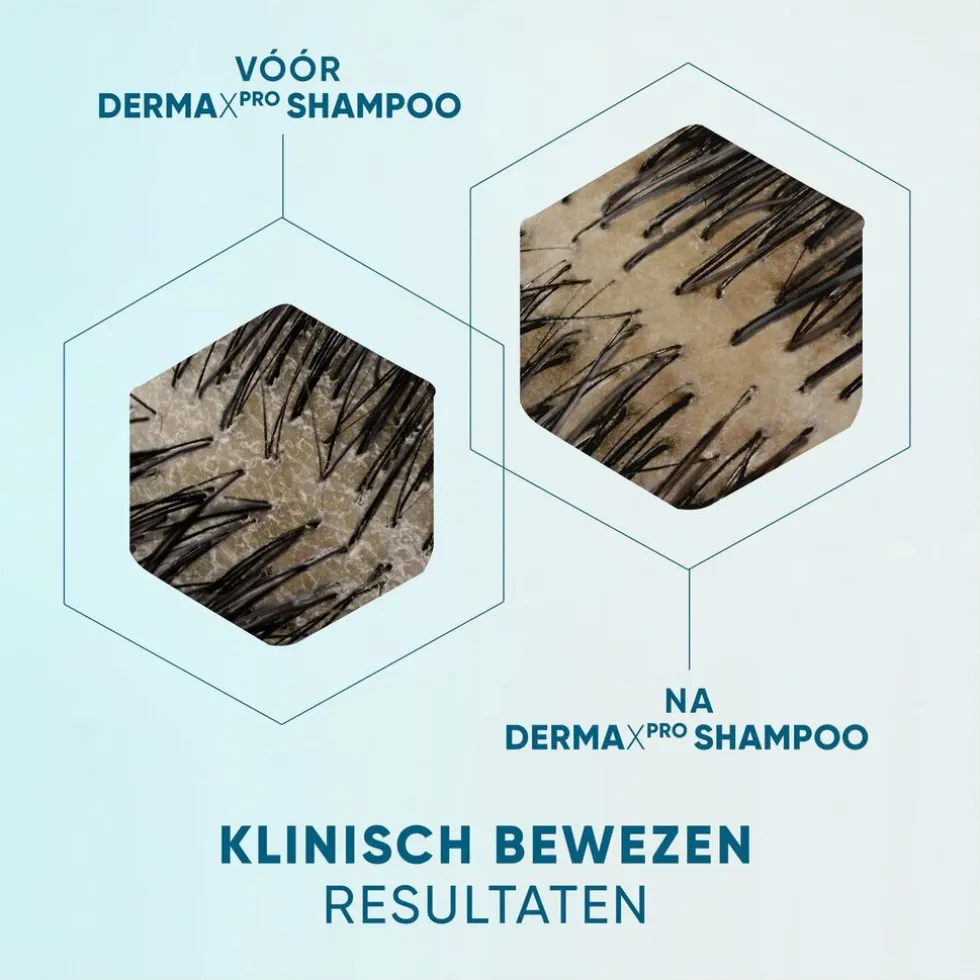 dermaxpro-by-head-shoulders-k-ZhoEBlfS-4.webp Outlet Head & Shoulders DermaXPro By Kalmeert Antiroosshampoo