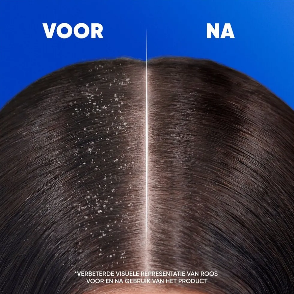 head-shoulders-jeukende-hoofd-yjXWhitE-3.webp Clearance Head & Shoulders Jeukende Hoofdhuid Antiroosshampoo