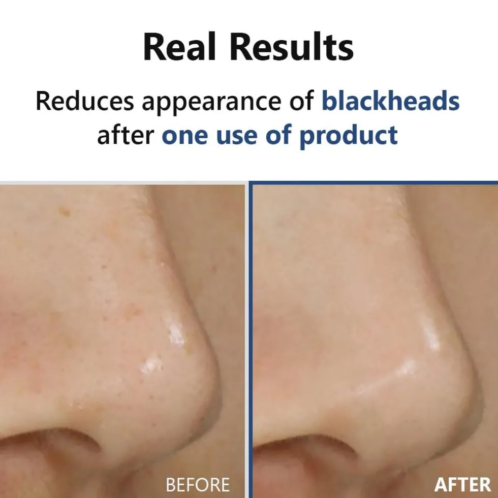 isntree-hyper-acid4-aha-bha-ph-toRiWOEC-2.webp Discount ISNTREE Hyper Acid4 AHA BHA PHA LHA 30 Serum