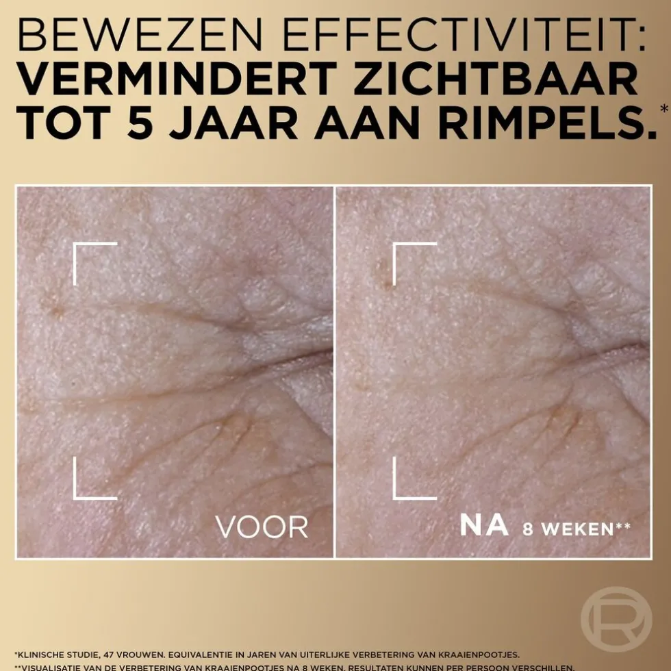 loral-paris-age-perfect-le-duo-tQvjBUCz-4.webp Hot L'Oreal Paris L'Oréal Paris Age Perfect Le Duo Anti-age Serum