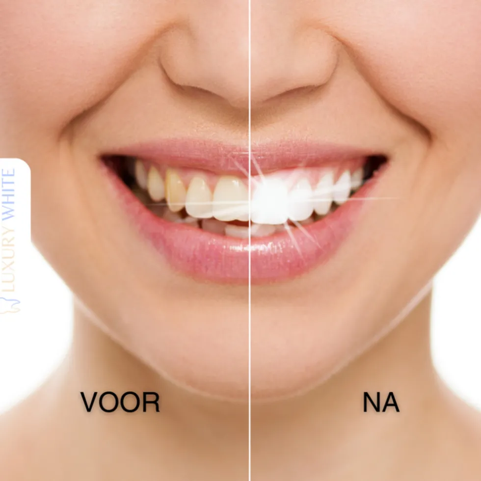 luxury-white-ultimate-whitenin-nQPCPrnn-1.webp Outlet Luxury White Ultimate Whitening+