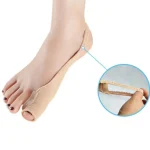 medical-brace-bunion-corrector-ytfXVMiN-0.webp