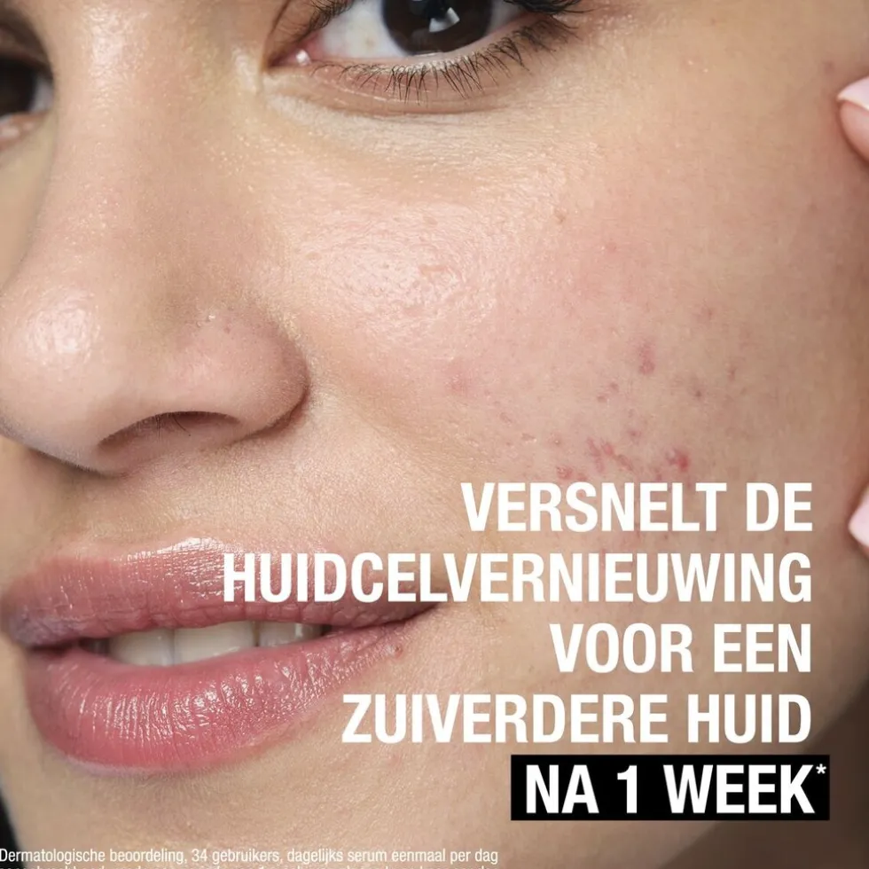 neutrogena-anti-puistjes-7-aha-mmNZQIAD-4.webp Hot Neutrogena Anti-Puistjes+ 7% AHA + Panthenol Vloeibare Exfoliant