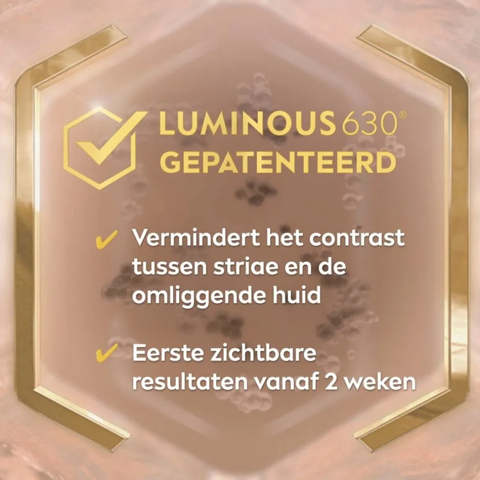 nivea-luminous630-anti-striae-ttkgmgzh-1.webp Clearance Nivea Luminous630 Anti-Striae Bodycrème