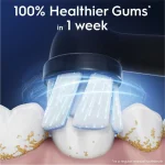 oral-b-io-gentle-care-opzetbor-wOpZgFXp-0.webp