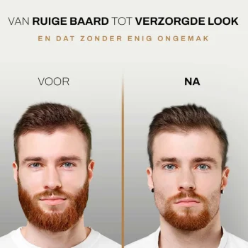 Fashion Sansbeauté 6-in-1 Baardtrimmer Met Opbergstandaard - Bodygroomer - Haartrimmer